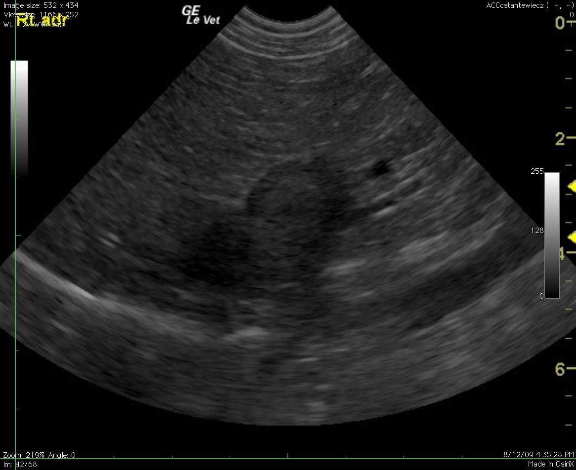 candy_staniewics_andi_park_rt_adrenal_mass