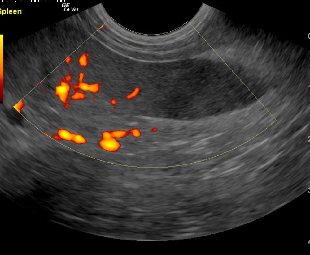 shebasplenicinfarct2
