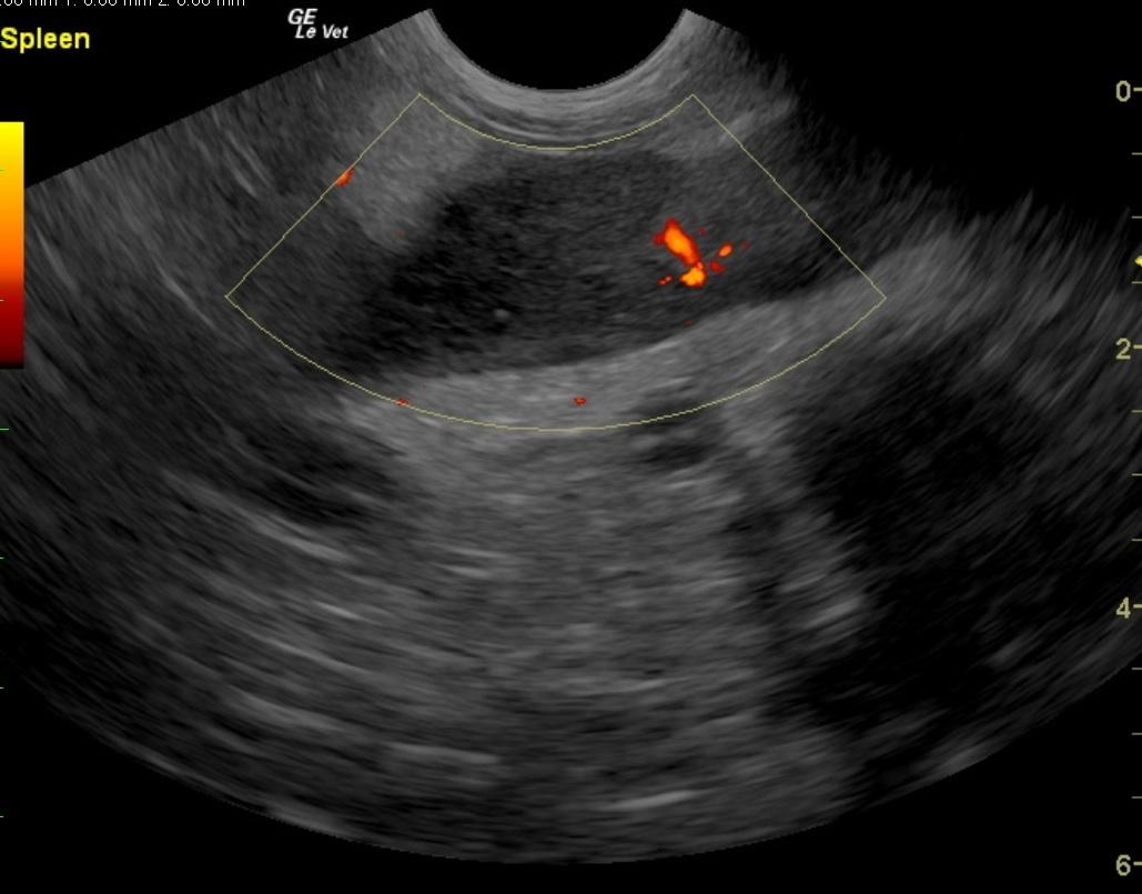shebasplenicinfarctpdop1