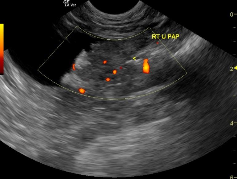 Rightureteralpapilla