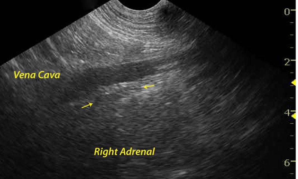 ATLAS260GypsyA_03192011121405