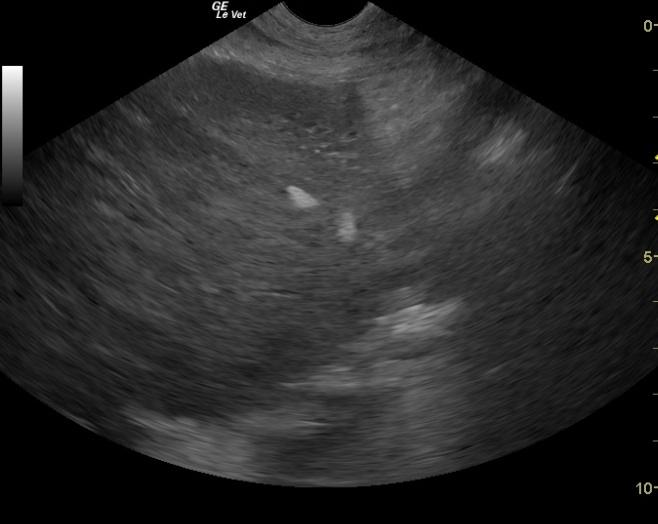 Hepatocelularvacuolization