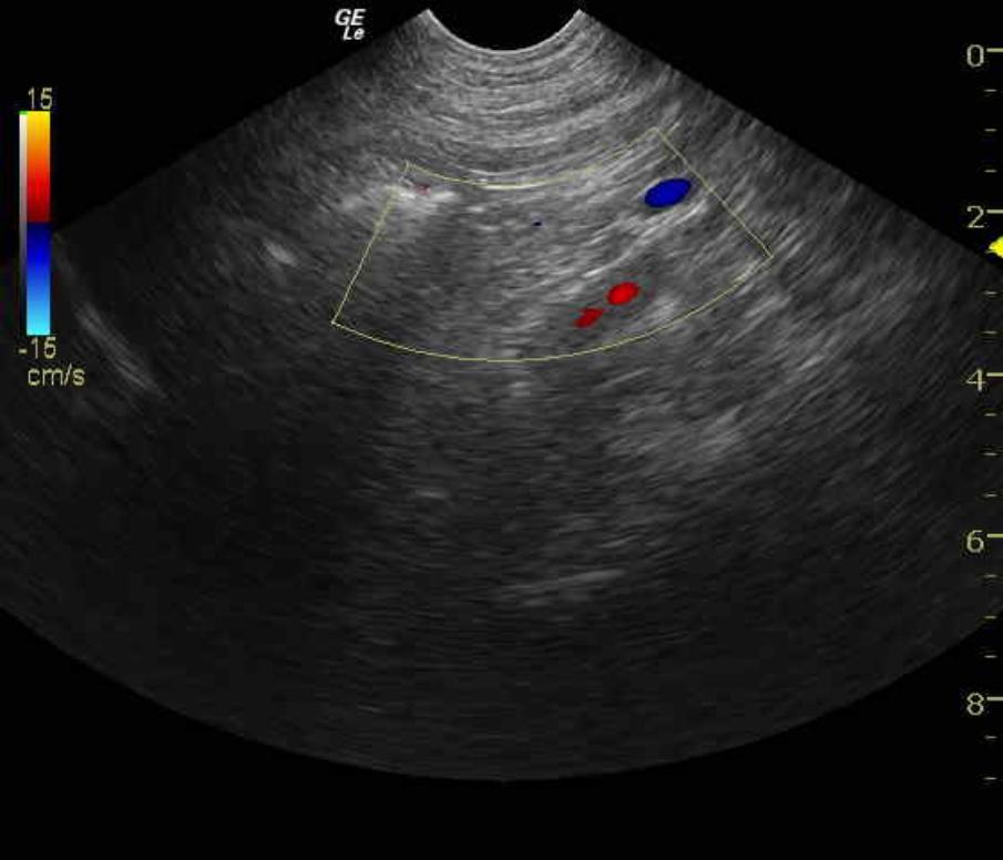 gypsyackersonleftadrenaladdisons0700023_07162011100453