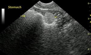 Gastric FB vs. pills on sonogram