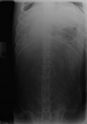 12 year old FS lab, acute onset intractable vomiting