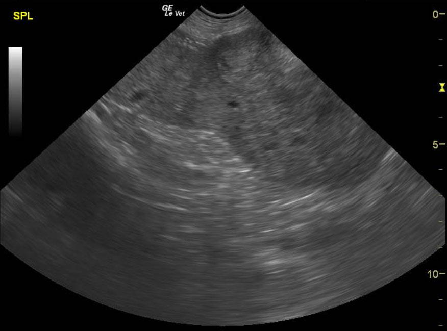 SpleenShermanGunnnosigsplenichematoma1_08262012050846