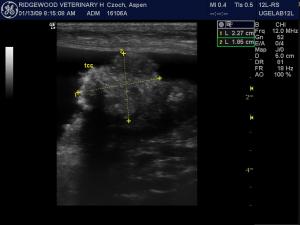 Bladder tumors resctable vs non & the UGELAB
