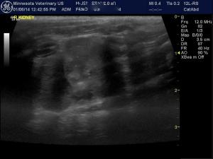 Hematuria and Renal Pathology