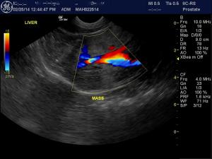 Another Cat Liver Mass