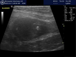 Hyperparathyroidism and Bladder Neoplasia with Suspected Liver Metastases
