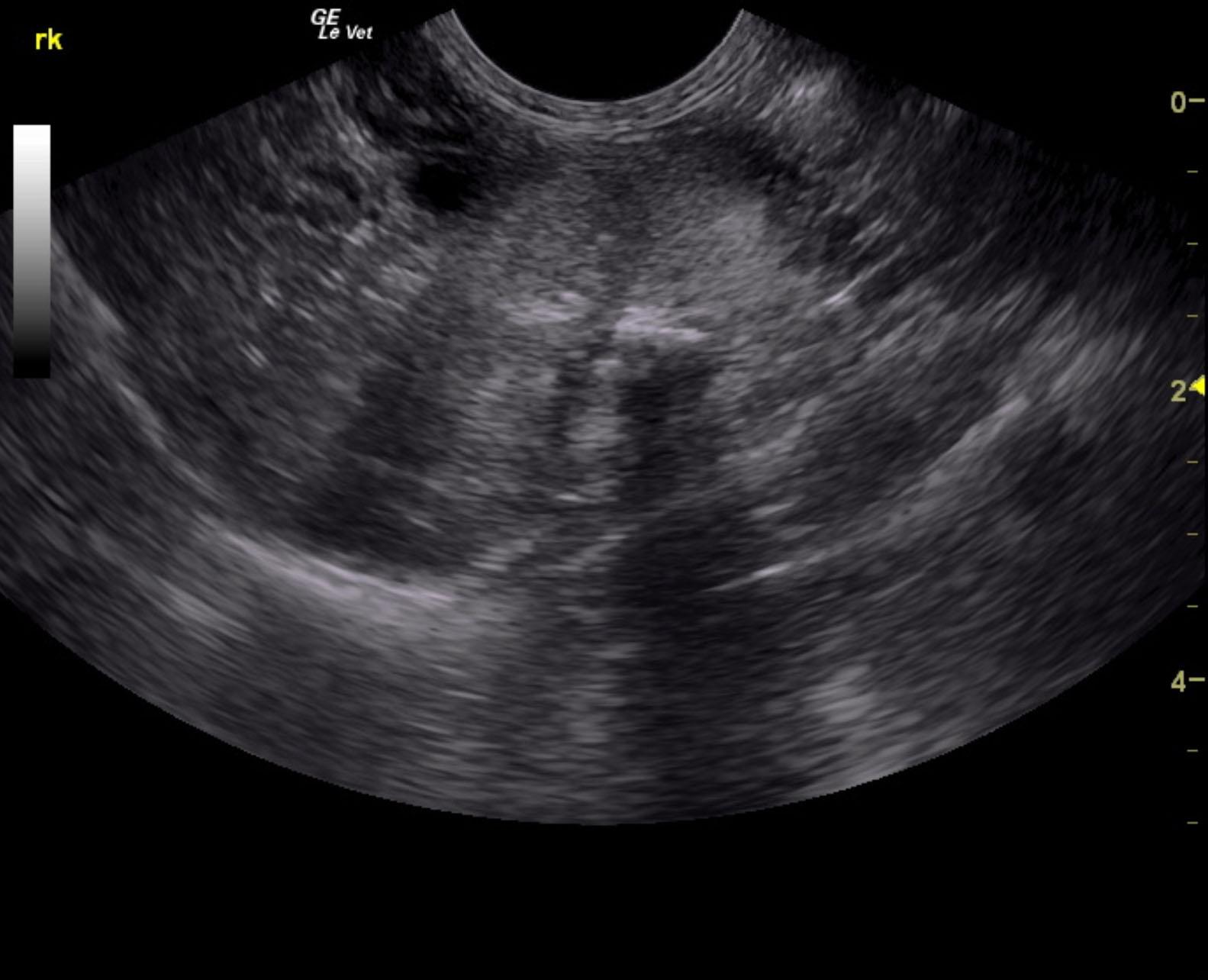 mitchell_tinker_bell_end_stage_crf_dystrophy_