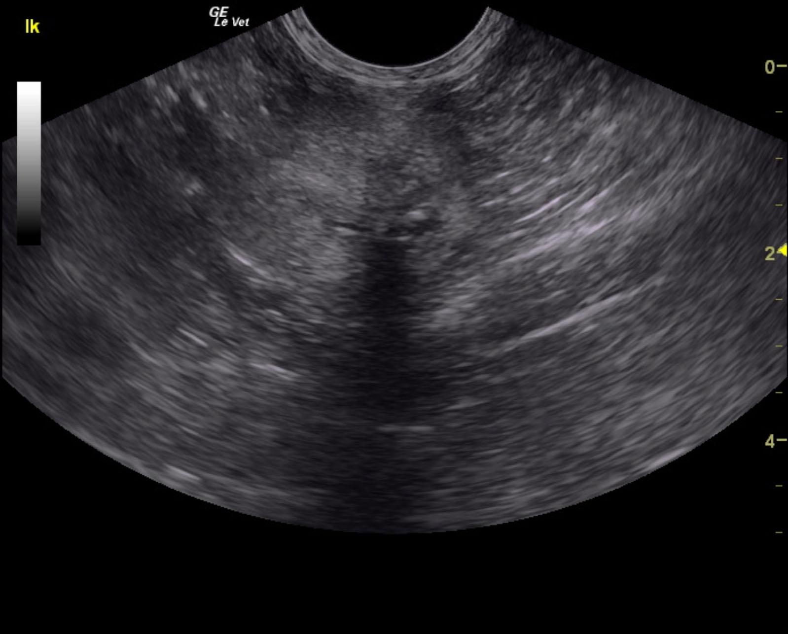 mitchell_tinker_bell_end_stage_crf_dystrophy_lk