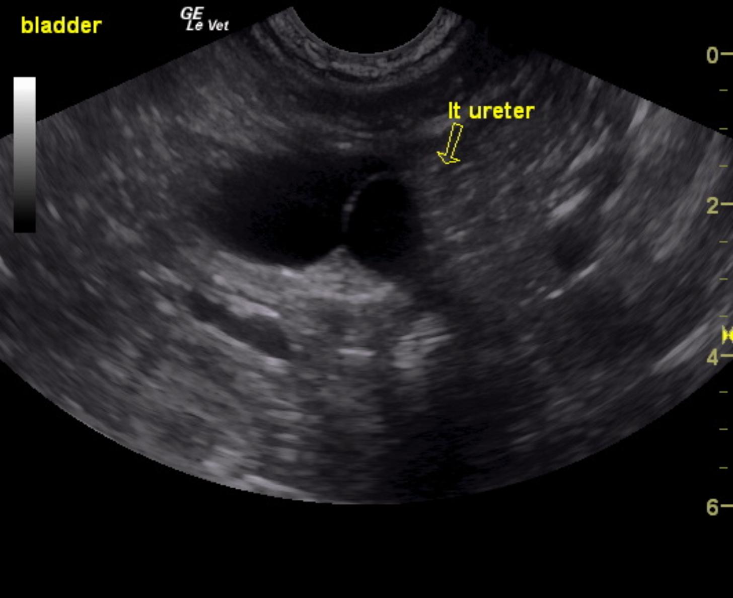 ectopic_ureter_intramural_schumacher_noaa_4_arrow