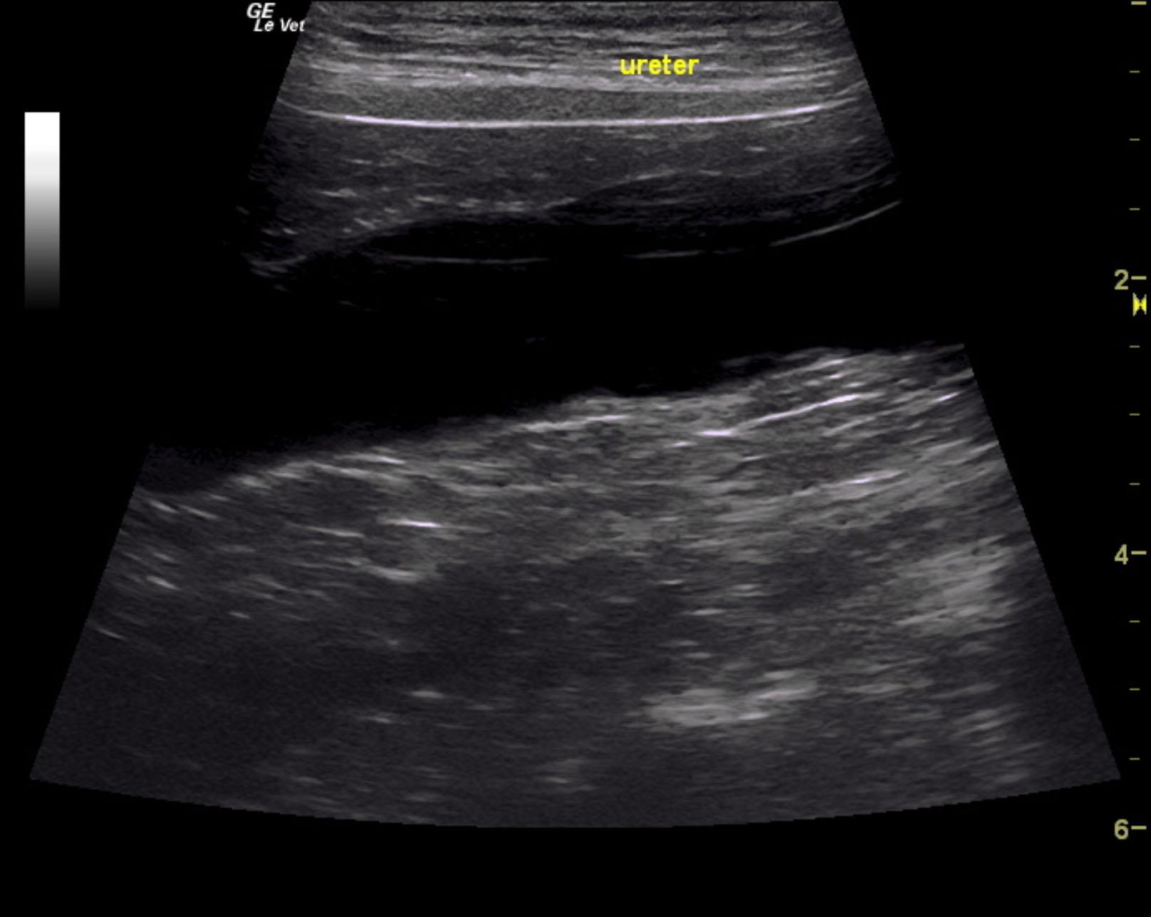 ectopic_ureter_intramural_schumacher_noaa_5