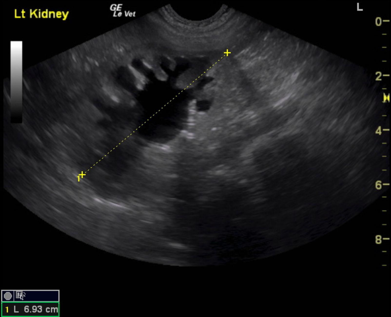 ectopic_ureter_intramural_schumacher_noaa_lk_6