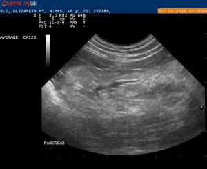 Pancreatitis