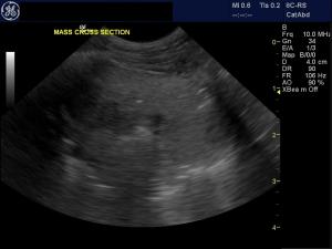 Lung mass in a couging miniature poodle