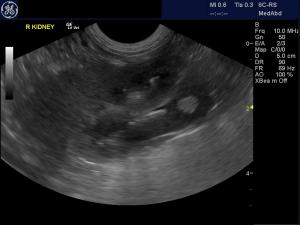 True and complex renal cysts in a 9 year old Yorkie