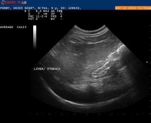 Feline with Chronic Vomiting and Pica