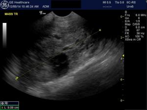 SQ Mass and echymosis in a 5 year old Pit Bull