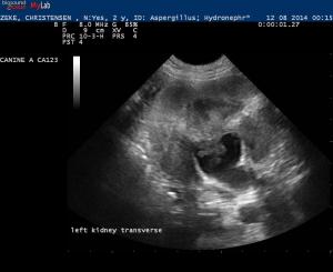 Systemic Mycosis with acute renal failure