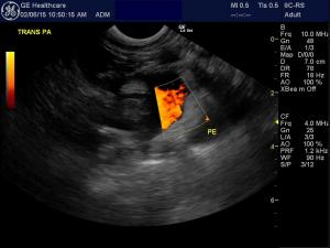 End stage myocardial failure in a cat