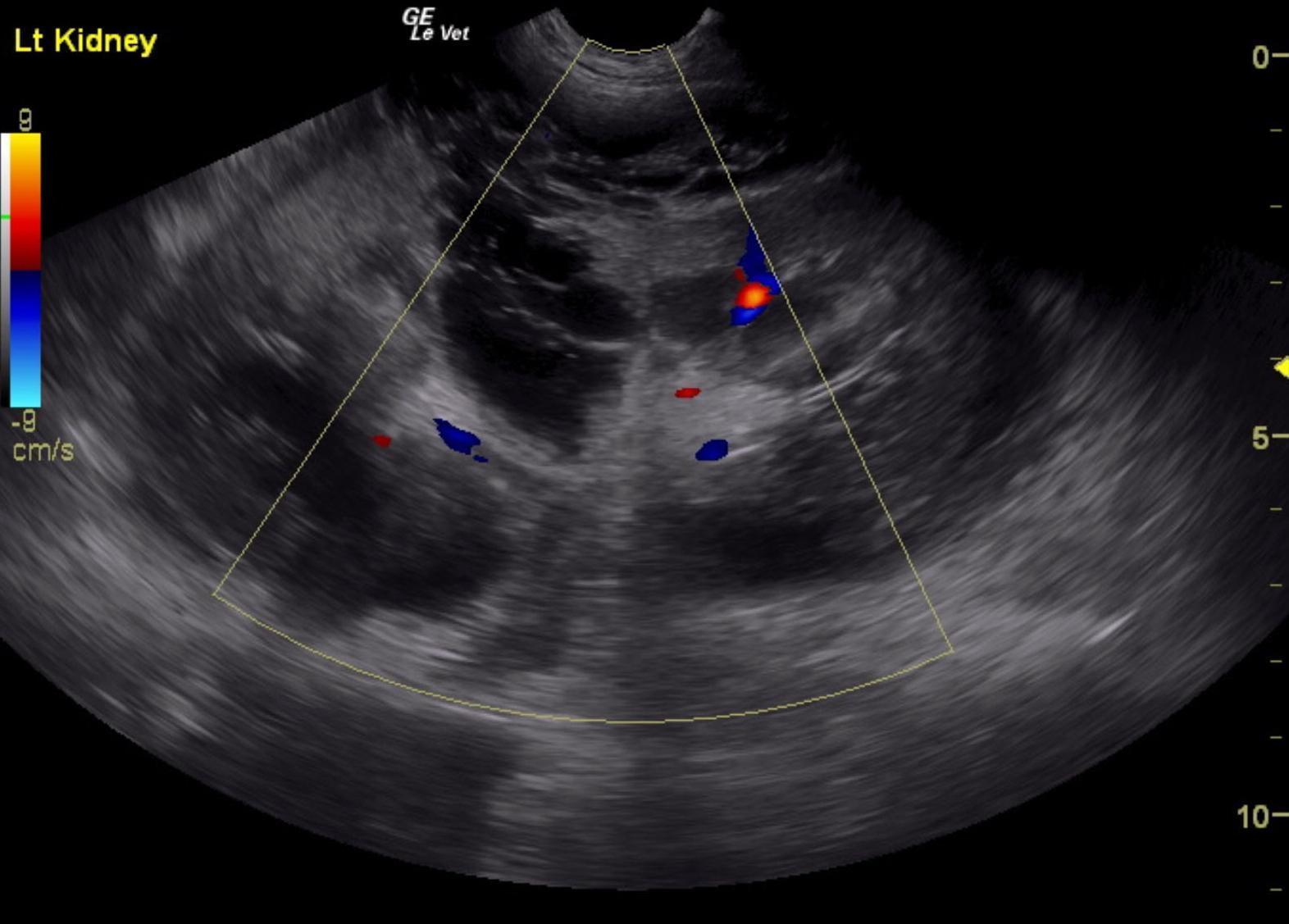 rocky_galloway_lk_hsa_original_12_5_prior_to_med_tx_2_copy