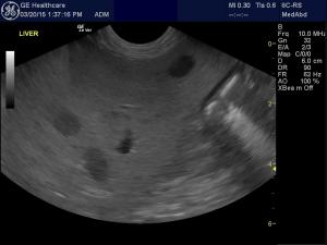 Hepatic nodules and cysts in a Cairn Terrier