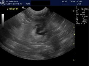Acute renal failure in a 1 year old mn cat