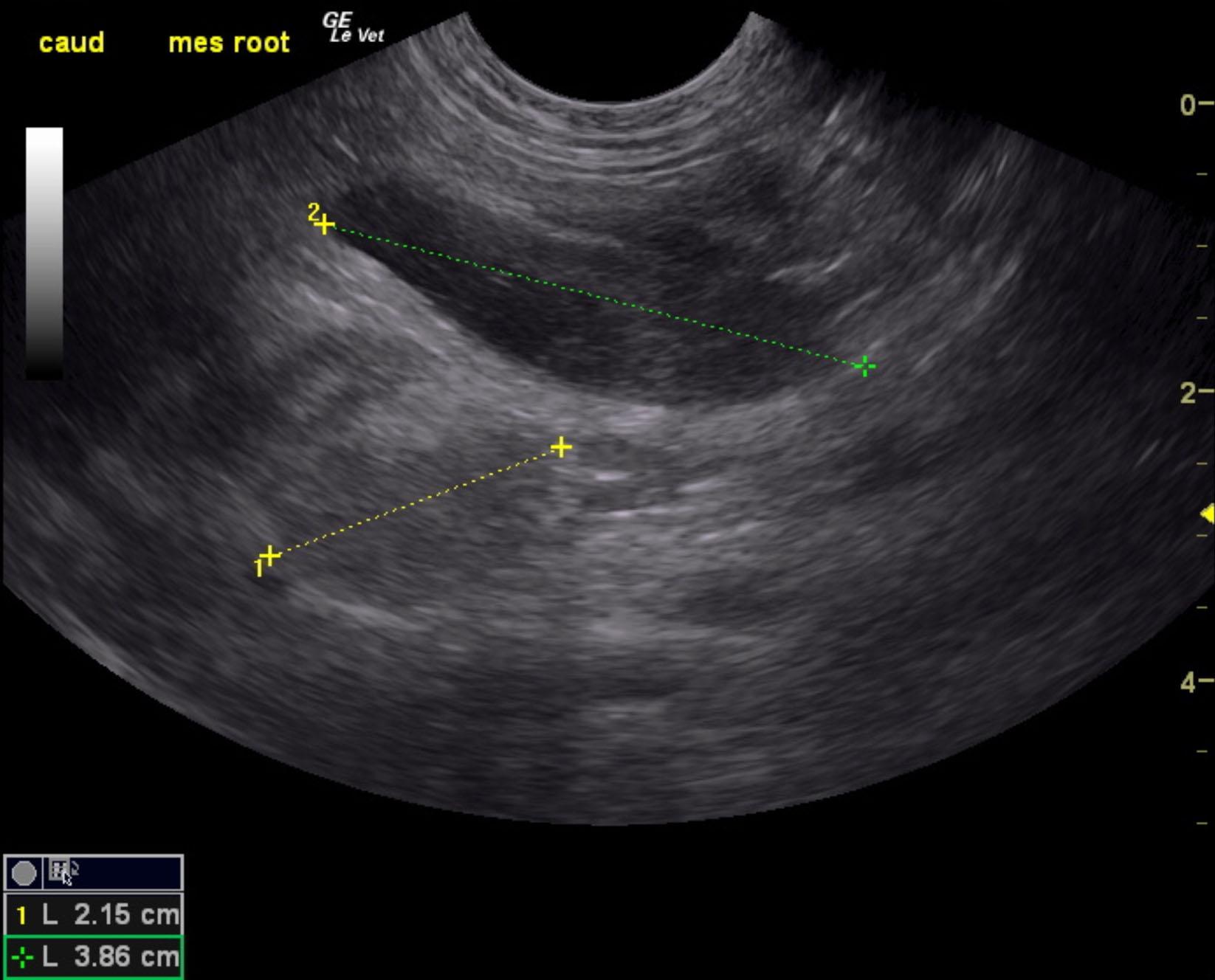 buddy_miller_intussusception_mes_ln