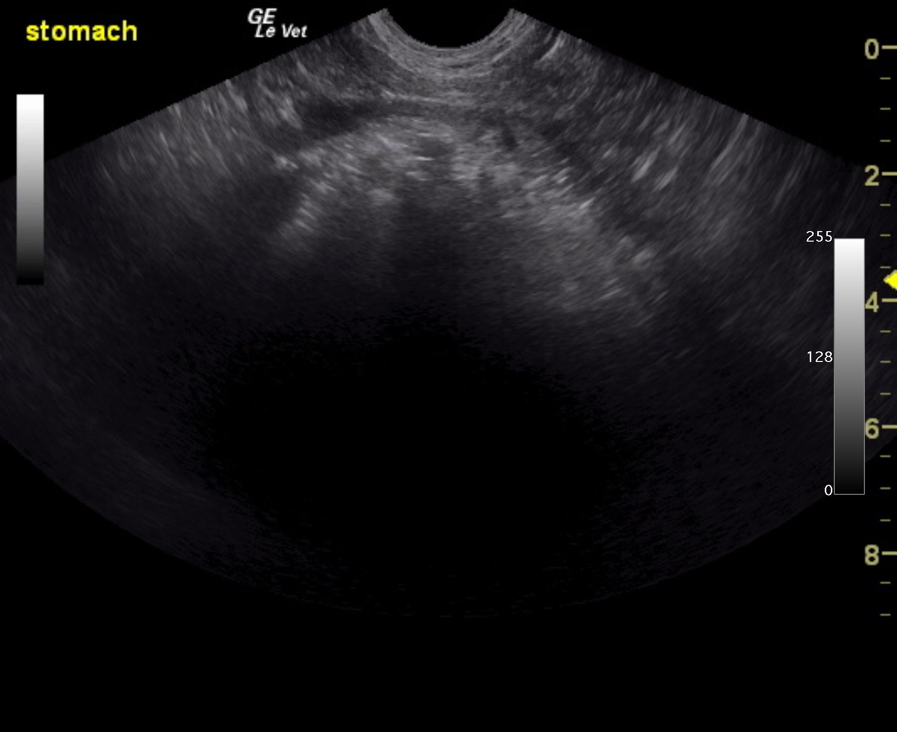 buddy_miller_intussusception_mes_ln_stomach_full