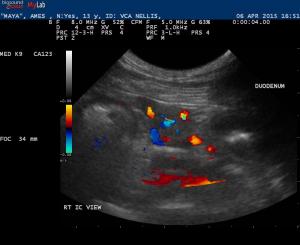 Possible insulinoma