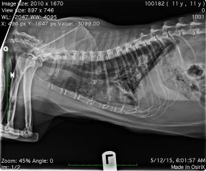 FNA Thoracic Mass