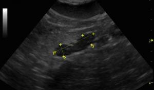 Adrenal Size FYI from VET RAD & US
