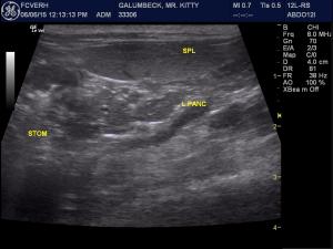renoliths, chronic kidney changes and possible infarcts?