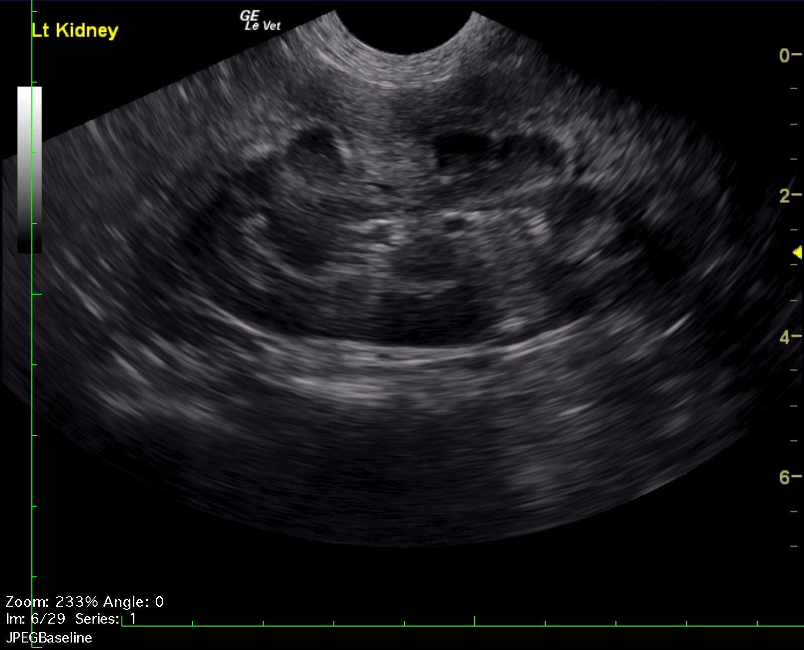 fletch_talbot_hypercaclemia_lsa_lk_2