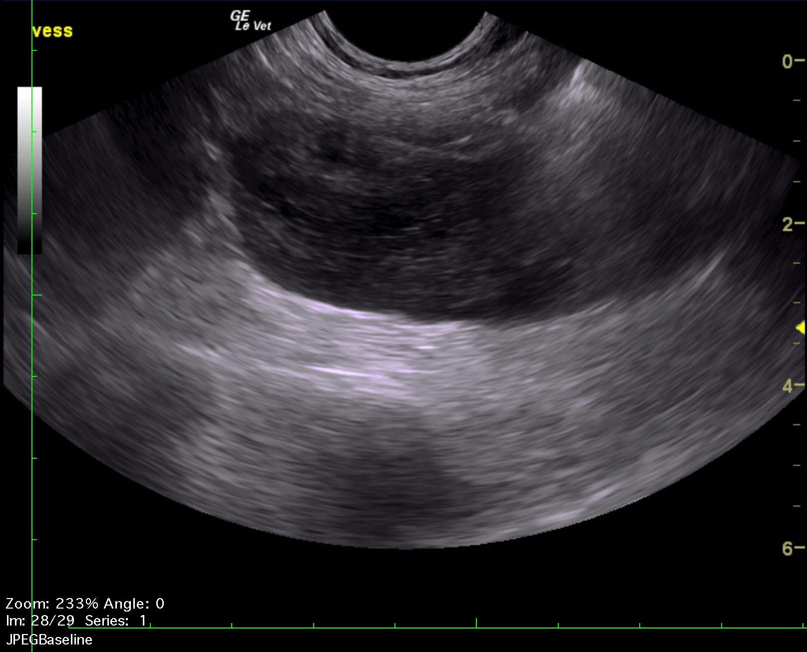 fletch_talbot_hypercaclemia_lsa_ln_2