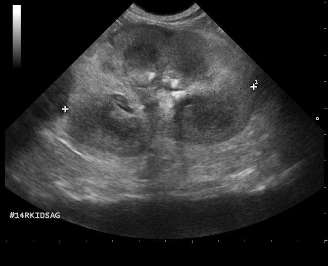 jack_thomson_20150505101031_1107370