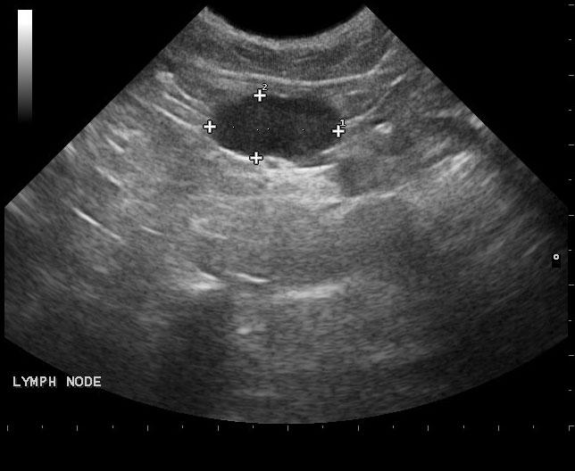 jack_thomson_20150505101031_1126570