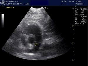 Echogenic density on feline echo