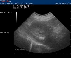 Gall bladder mucocele rupture??