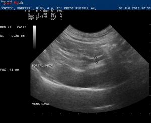 Small portal vein??