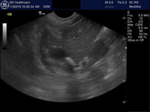 Cholecystitis and cholelithiasis in a 6 year old FS Cairn Terrier