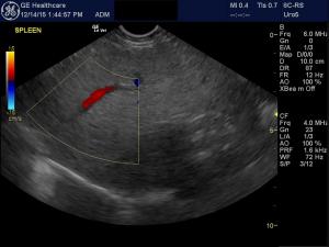 Thrombocytopenia and splenomegaly in a 5 yr old FS Greyhound