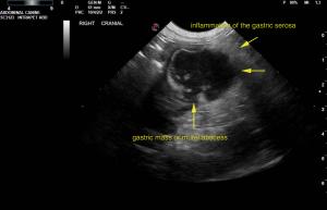 Abscess at left pancreatic base…. or is it?