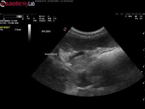 Pancreatitis with cysts and duct dilation in a cat