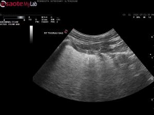 Looking for the lung lesions
