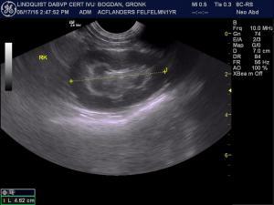 splenocaval shunt in 1 year old cat