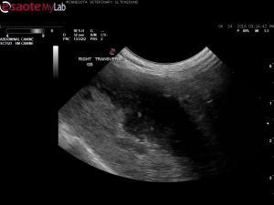 To Mucocele or Not to Mucocele