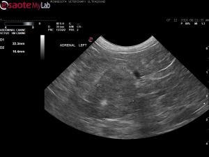 Bilateral adrenal masses in a 16 year old FS Cockapoo
